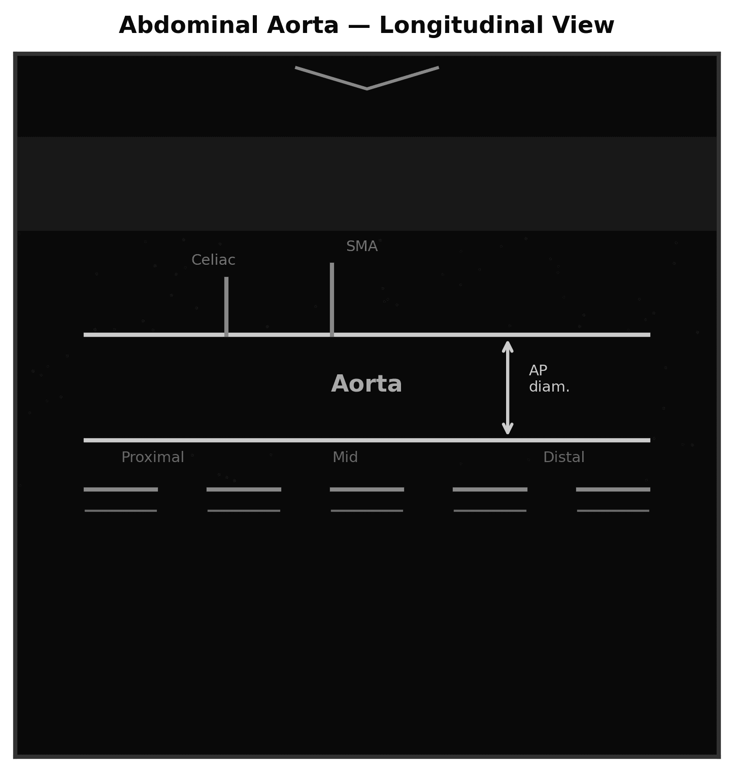 Abdominal Aorta (AAA) reference figure 2